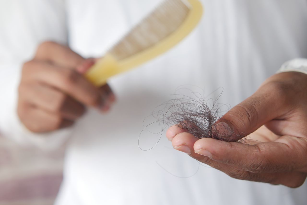 What Percentage of Men Go Bald? Hair Loss Facts and Statistics