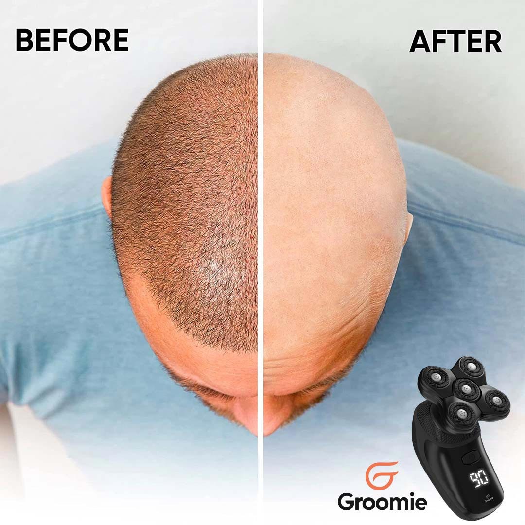 BaldiePro™ Head & Body Shaver